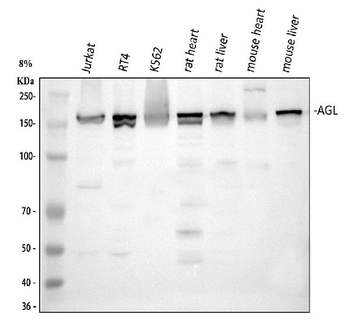 AGL Rabbit Polyclonal Antibody