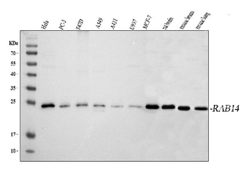 RAB14 Rabbit Polyclonal Antibody