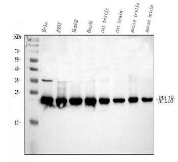 RPL18 Rabbit Polyclonal Antibody