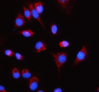 RPL18 Rabbit Polyclonal Antibody