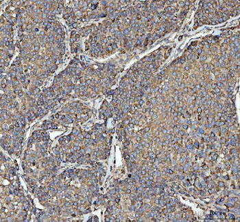 RPL18 Rabbit Polyclonal Antibody