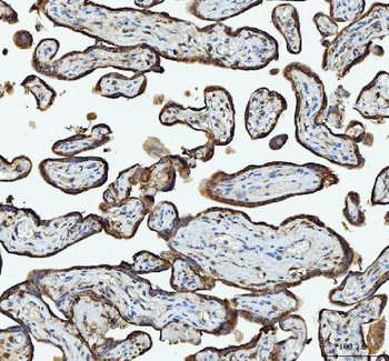 RPL18 Rabbit Polyclonal Antibody