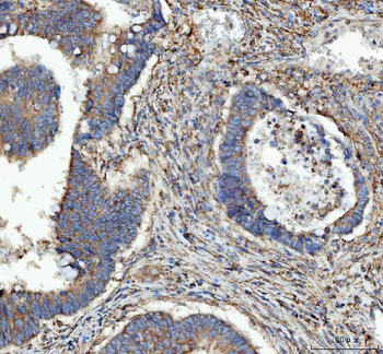 RPL18 Rabbit Polyclonal Antibody