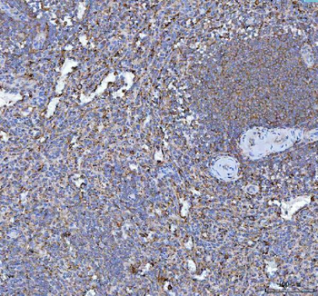 RPL18 Rabbit Polyclonal Antibody