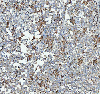 RPL18 Rabbit Polyclonal Antibody
