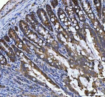 RPL18 Rabbit Polyclonal Antibody