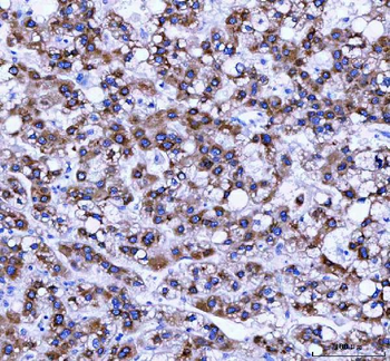 RRBP1 Rabbit Polyclonal Antibody