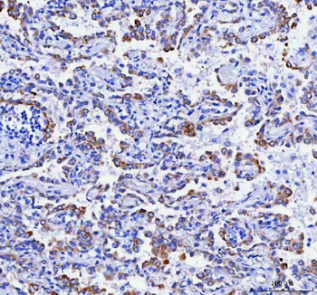 RRBP1 Rabbit Polyclonal Antibody