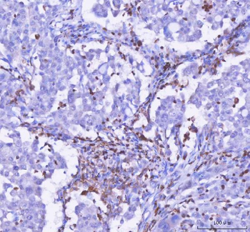 LPCAT2 Rabbit Polyclonal Antibody