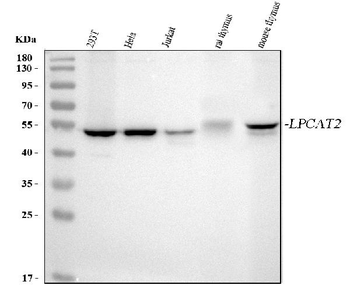 LPCAT2 Rabbit Polyclonal Antibody