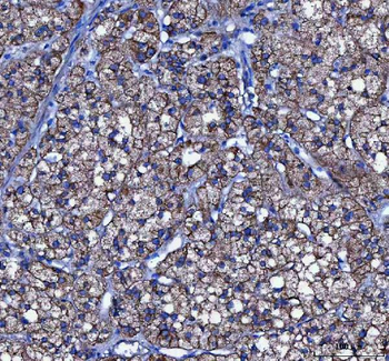 LIN7C Rabbit Polyclonal Antibody