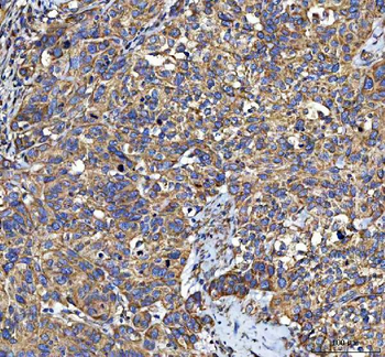 LIN7C Rabbit Polyclonal Antibody