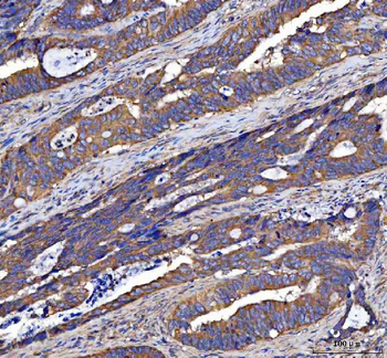 LIN7C Rabbit Polyclonal Antibody