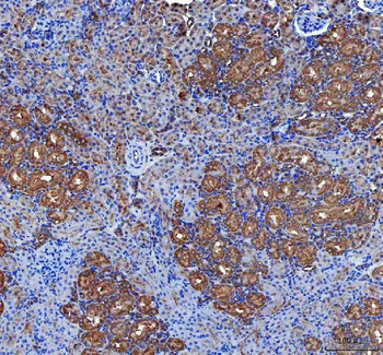 LIN7C Rabbit Polyclonal Antibody