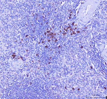 MZB1 Rabbit Polyclonal Antibody