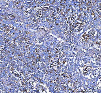 MZB1 Rabbit Polyclonal Antibody