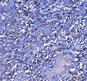 MZB1 Rabbit Polyclonal Antibody