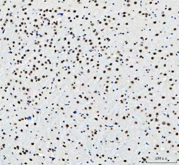 CROP/LUC7L3 Rabbit Polyclonal Antibody