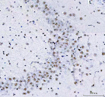 CROP/LUC7L3 Rabbit Polyclonal Antibody