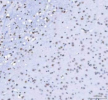 CROP/LUC7L3 Rabbit Polyclonal Antibody