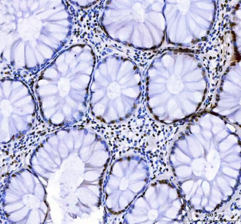 CROP/LUC7L3 Rabbit Polyclonal Antibody