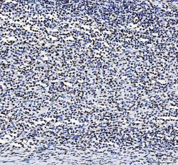 CROP/LUC7L3 Rabbit Polyclonal Antibody