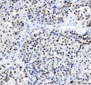 CROP/LUC7L3 Rabbit Polyclonal Antibody