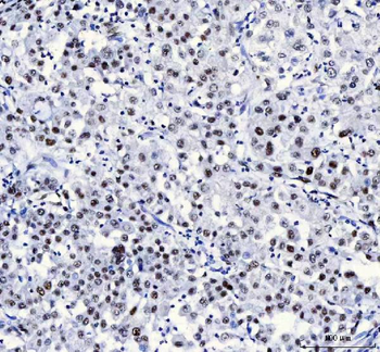 CROP/LUC7L3 Rabbit Polyclonal Antibody