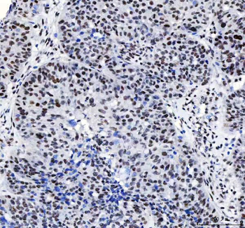 CROP/LUC7L3 Rabbit Polyclonal Antibody