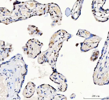 CROP/LUC7L3 Rabbit Polyclonal Antibody
