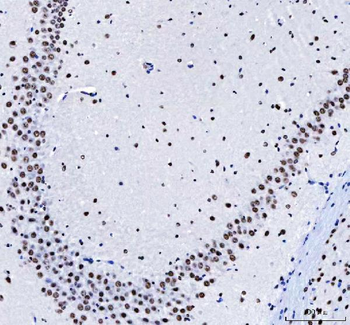 CROP/LUC7L3 Rabbit Polyclonal Antibody