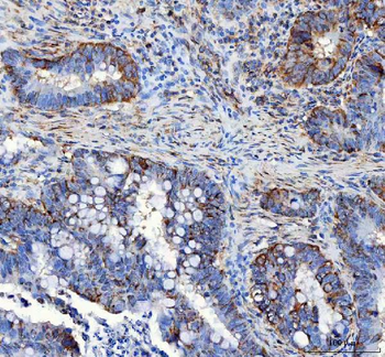 LRRC59 Rabbit Polyclonal Antibody