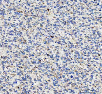 LDAH Rabbit Polyclonal Antibody
