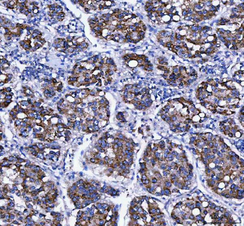LDAH Rabbit Polyclonal Antibody