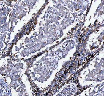 LDAH Rabbit Polyclonal Antibody