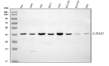 LDAH Rabbit Polyclonal Antibody