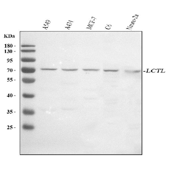 LCTL Rabbit Polyclonal Antibody