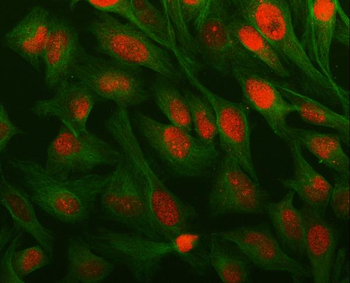 LAGE3 Rabbit Polyclonal Antibody