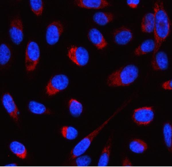 ATP5F1D Rabbit Polyclonal Antibody