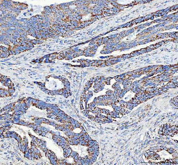 ATP5F1D Rabbit Polyclonal Antibody