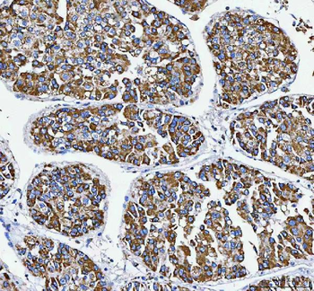 ATP5F1D Rabbit Polyclonal Antibody