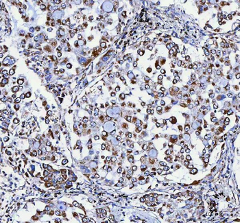 ATP5F1D Rabbit Polyclonal Antibody