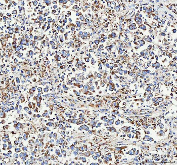 ATP5F1D Rabbit Polyclonal Antibody