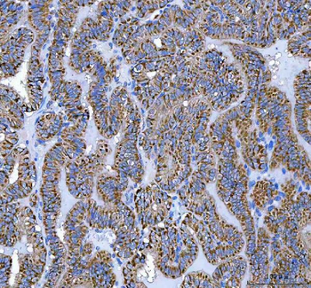 ATP5F1D Rabbit Polyclonal Antibody