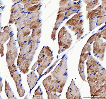 ATP5F1D Rabbit Polyclonal Antibody