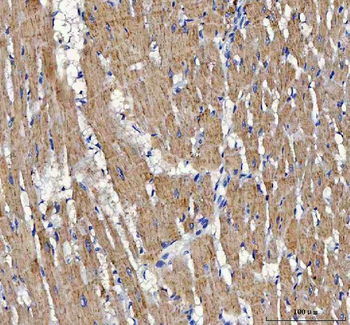 ATP5F1D Rabbit Polyclonal Antibody