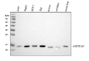 ATP5F1D Rabbit Polyclonal Antibody