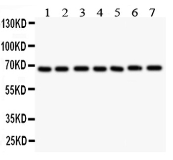 GAD67/GAD1 Rabbit Polyclonal Antibody