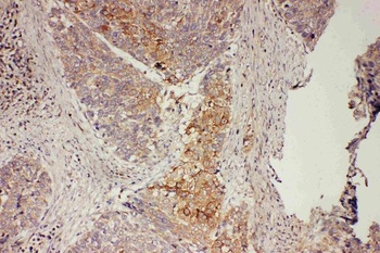 GRB7 Rabbit Polyclonal Antibody