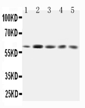 GRB7 Rabbit Polyclonal Antibody